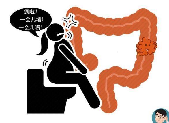 晨起上厕所,排便若有3种迹象,警惕"癌细胞"来报道,及时检查