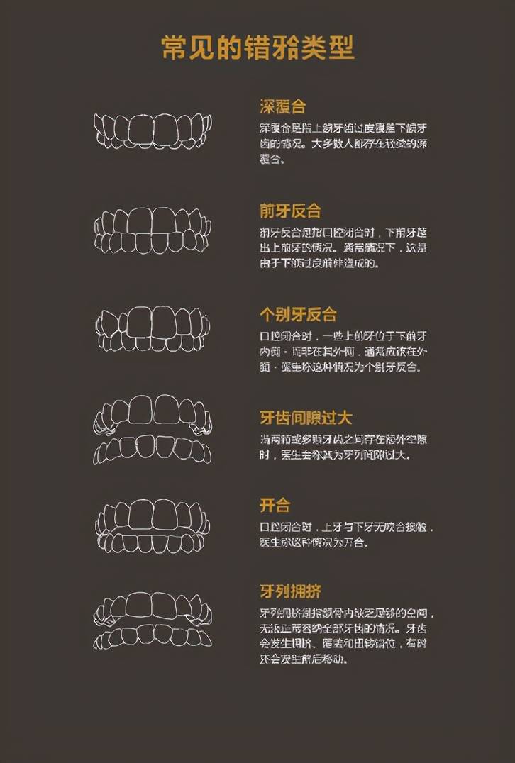 别诓我3d打印竟然能矫正牙齿