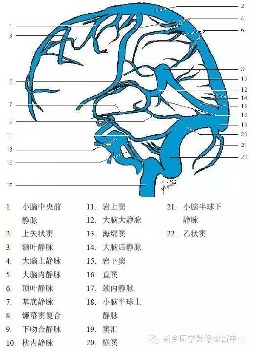 脑血管解剖图谱:详细标注 脑梗死责任血管判定