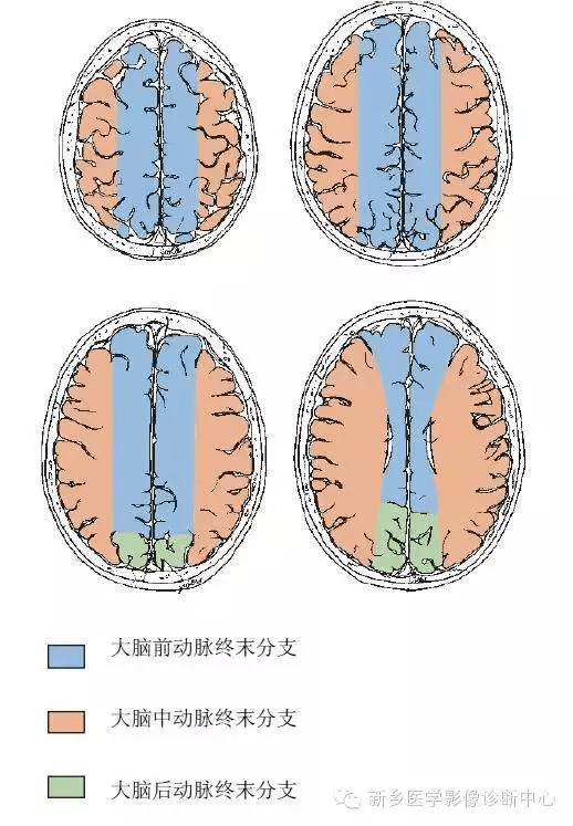 脑血管解剖图谱:详细标注 脑梗死责任血管判定