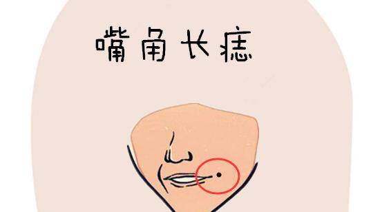 嘴角长痣在嘴角的位置处长有恶痣,被称之为"贪吃"痣,大多数的情况下