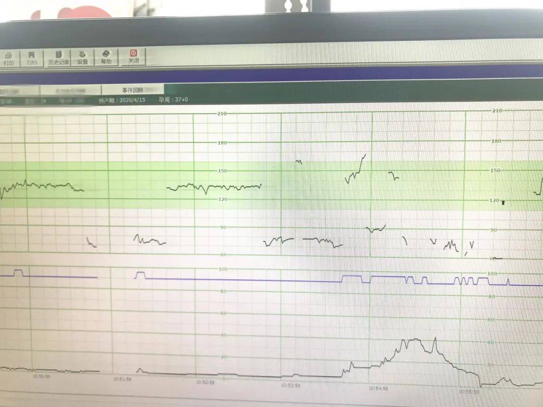 其他一切正常,但在做胎心监护时却出了问题,负责做胎心监护的医护人员