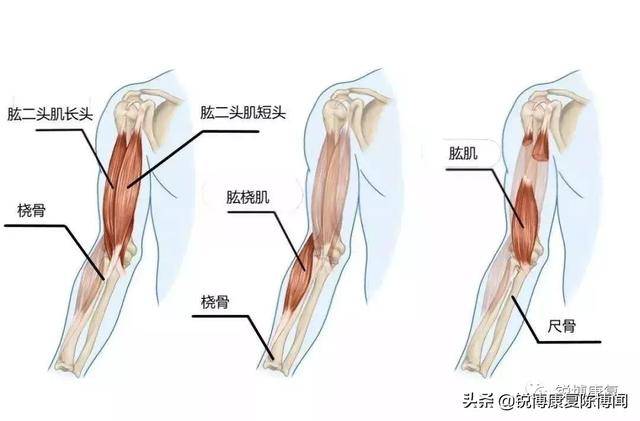 这时你的 肱二头肌肌腱会伸展到极限,这时很容易导致肌腱拉伤