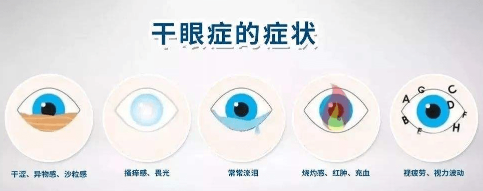 维适眼科王军主任:长期对着电脑的你有没有干眼症呢?赶紧看一看