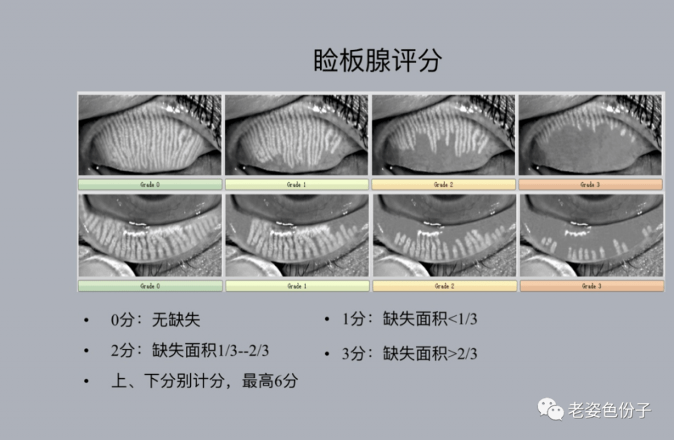 为您的睑板腺拍照做专业的分析,根据检查结果进一步制定后续的治疗,也