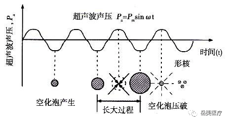 网络疯传的"超脂塑"吸脂,到底啥来头?_超声
