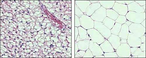 显微镜下的脂肪"小房间"