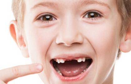 5岁娃满口黑牙吓坏医生!儿童牙齿护理,做好两点就够了