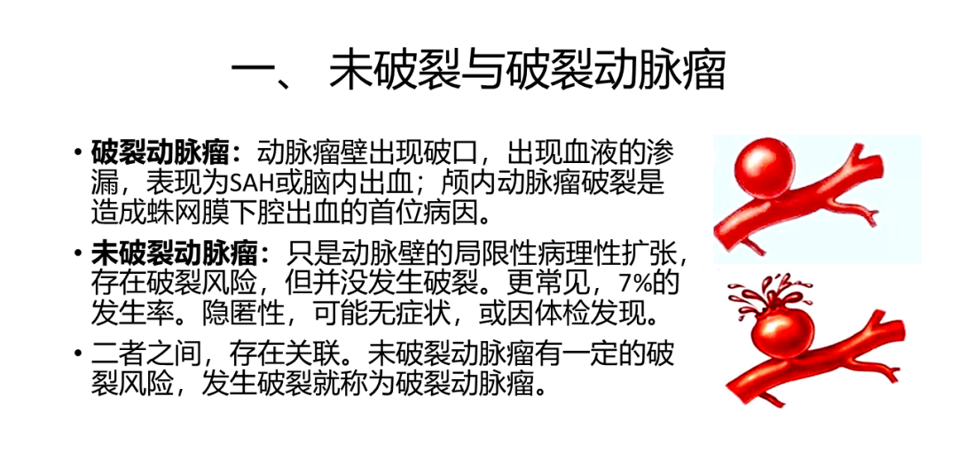 颅内动脉瘤的分类有多种:那么当我们听到"动脉瘤"这个名称时,你会想到