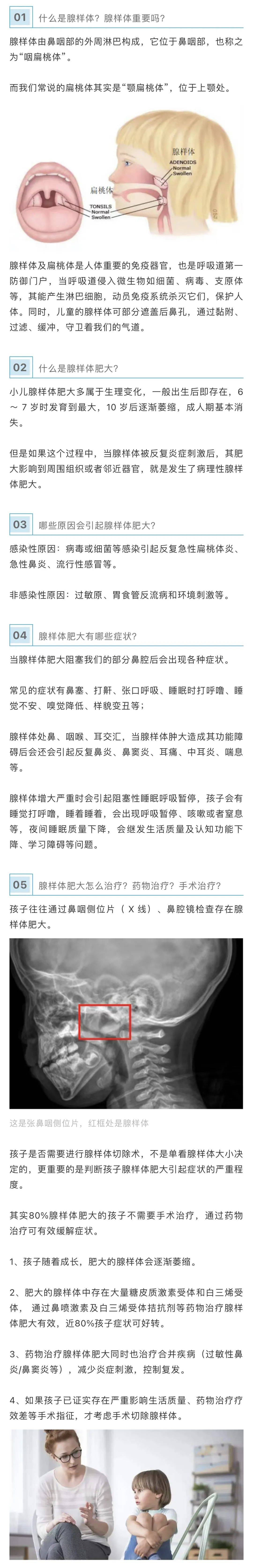 有些孩子样貌会变丑生活质量及认知功能下降等呼吸暂停,生长发育障碍