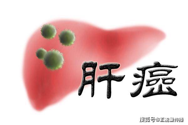 肩膀疼痛就是
