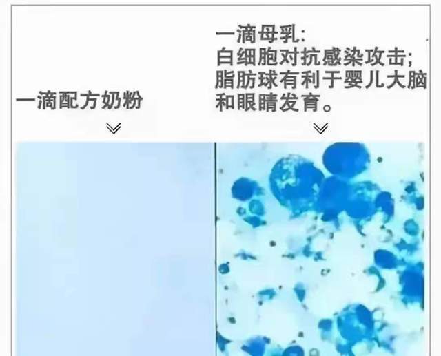 母乳到底有多＂神奇＂？一个实验告诉你,新手妈妈可别不在意