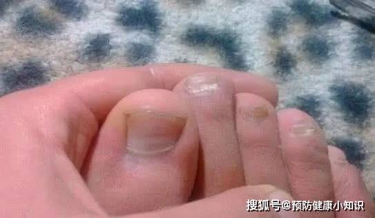 两只脚的脚掌都是白色的