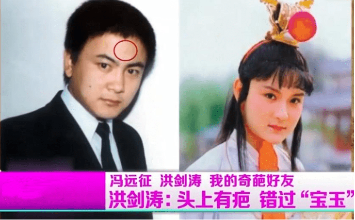 这个疤让洪剑涛失去了贾宝玉的机会, 因为集万千宠爱于一身的贾二爷