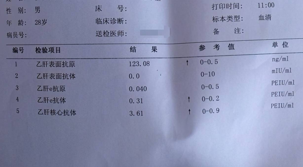 5,乙型肝炎核心抗体