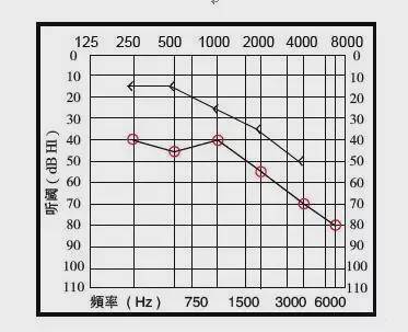 一分钟教你看懂耳朵听力报告