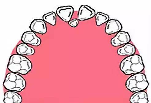 10,恒牙不萌出或埋伏阻生