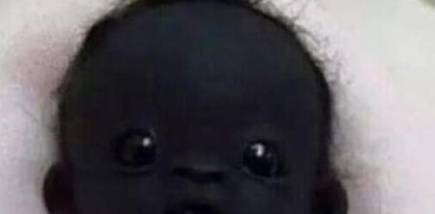 原创三年前早产的"圣婴",被称"世界最黑"婴儿,现状如何?