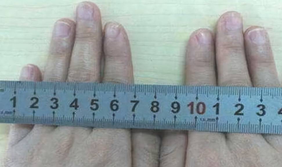 女性顺产时,＂开十指＂是十个指头那么宽吗？镜头记录顺产全程