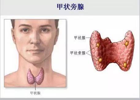 在甲状腺腺体上,有4个黄豆大小的东西,它的学名叫——甲状旁腺.
