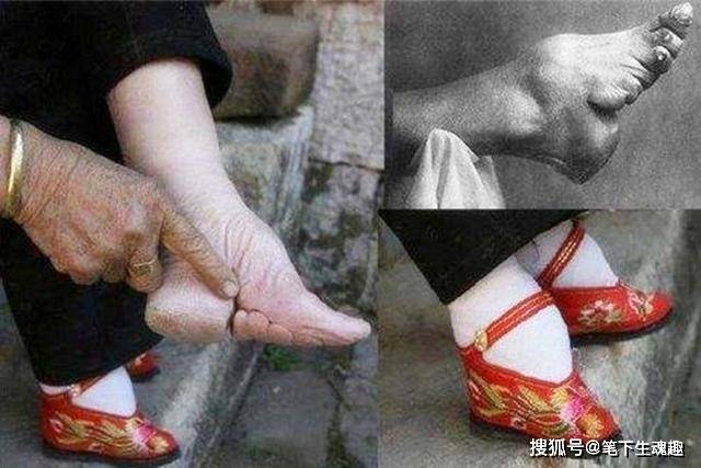 现今看来非常变态的"缠足"行为,为什么在中国持续了一
