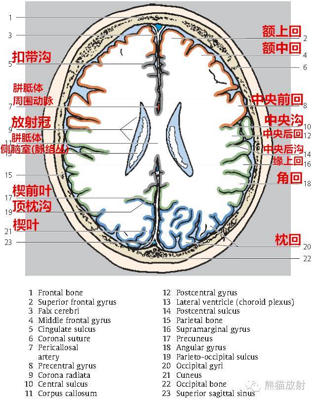 解剖颅脑ct断层中英文对照干货满满