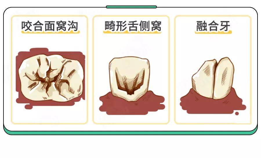 5岁儿童蛀牙率70%！别只＂控糖＂了,这件事更要紧！