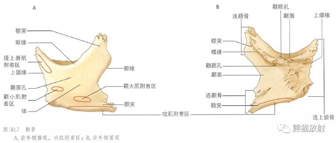 颧骨  