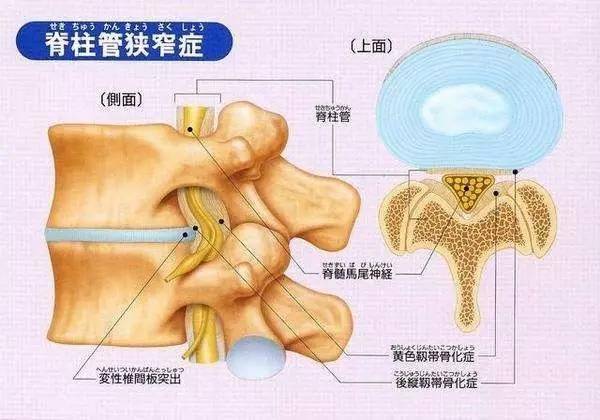 医生提醒_小心不要被骗了,这三种骨科疾病无法彻底治愈