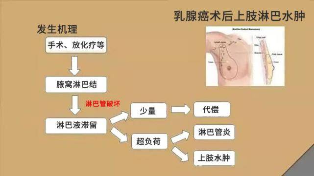 根据乳腺癌手术淋巴结清扫范围和术后放疗时患侧腋窝暴露程度及放疗总