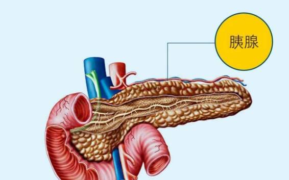 原创癌症之王胰腺癌有这些特征的人风险最高