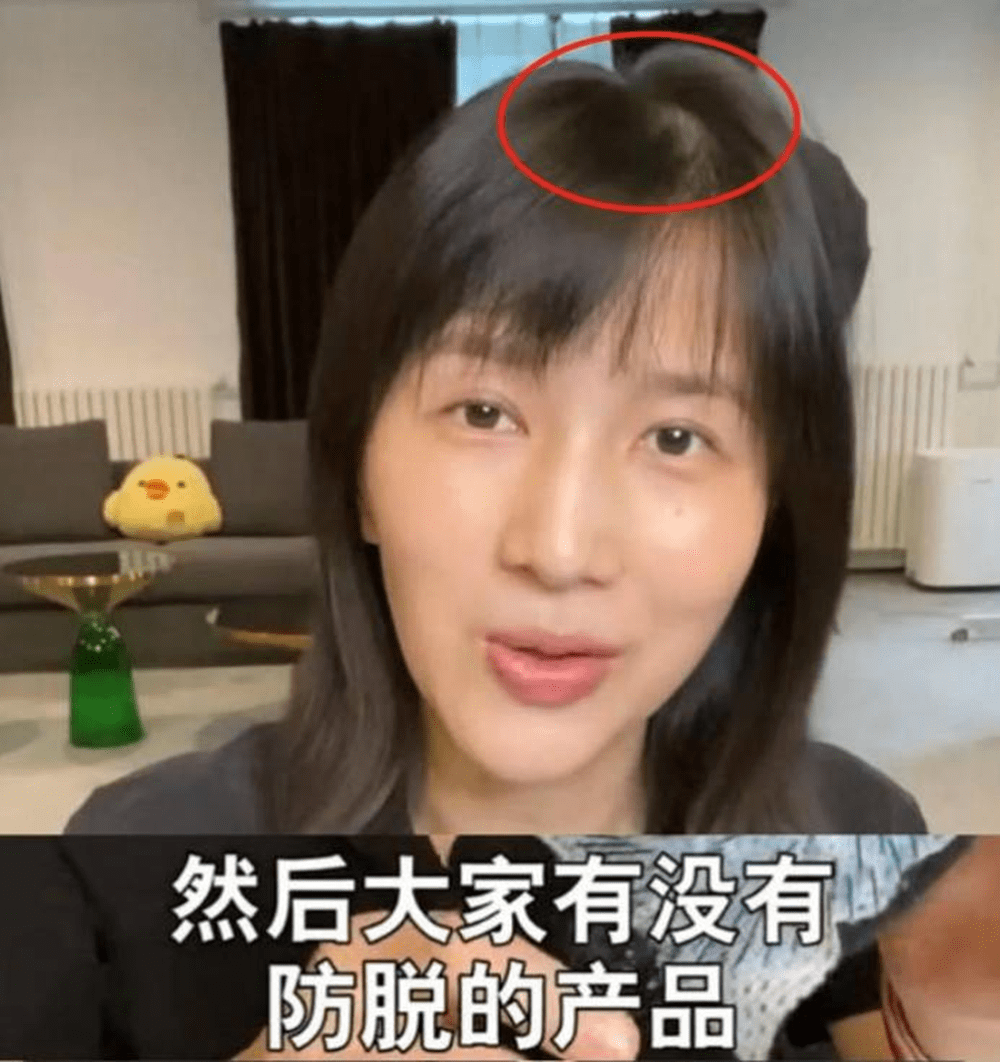 生娃后你的头发还好吗？产后脱发严重的问题,要如何面对