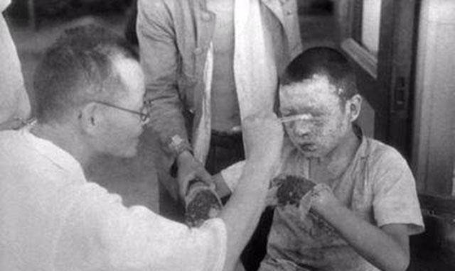 原创日本大内久工作失误遭辐射医生为获取实验数据强行救治83天