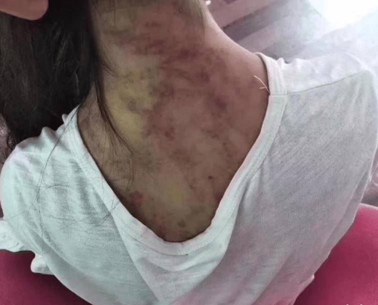 居委会主任马育英等人当天晚上就来到燕志云家,寒冬中,小丽丽穿着破烂