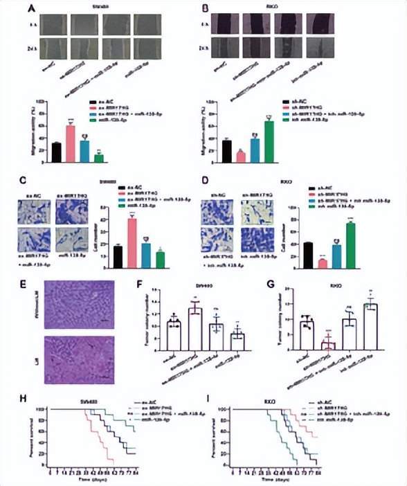【文献解读】cerna 糖酵解_lncrna_细胞_相关