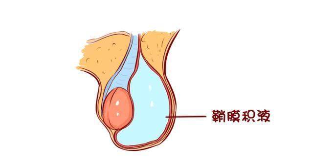 阴囊_症状_睾丸