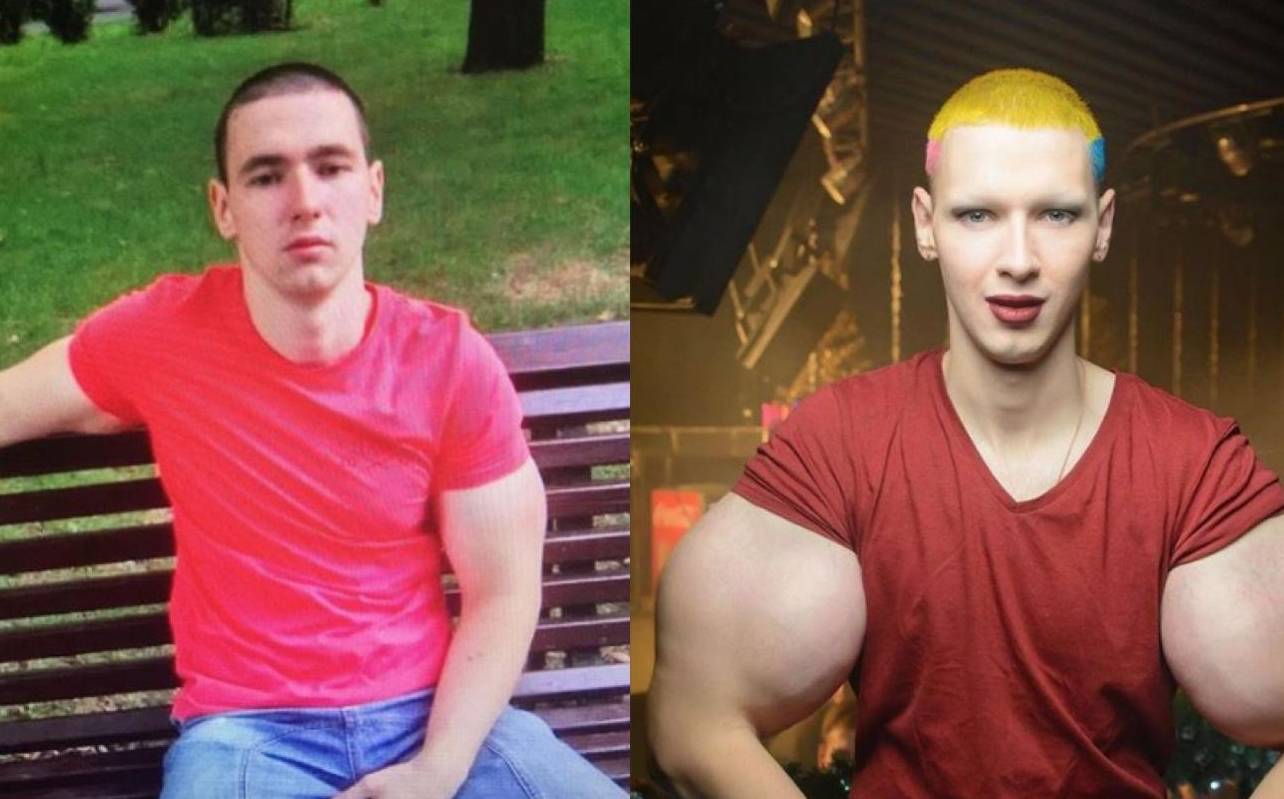 盘点健身圈"西斯龙肌肉怪,其中还有ifbb职业健美运动员!