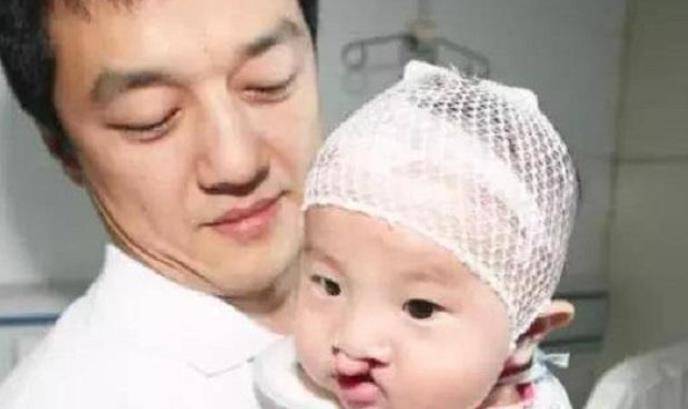 李嫣近照曝光,与父亲跑步显露曼妙身姿,"兔唇"已基本消失_王菲_李亚鹏