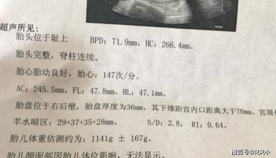 "孕28周 产前第一道坎 5件重要事情都发生在这个时期_胎儿_检查