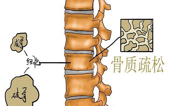 人到中年，骨量流失，哪些食物能补钙？早点补，预防骨量松散