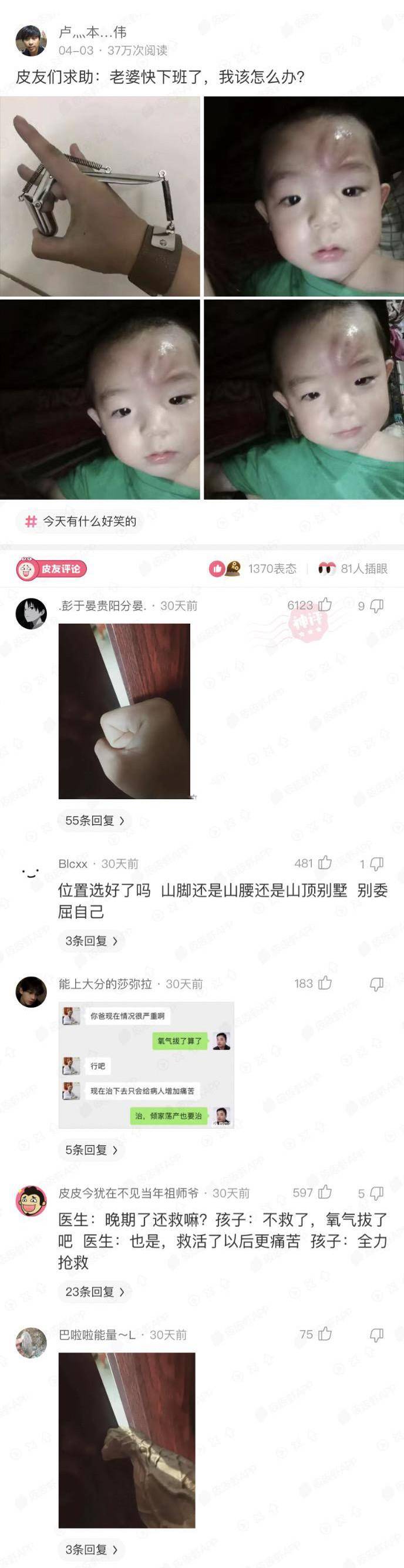 神回复：把儿子头弹破了，妻子马上回家怎么办？我只想留条命