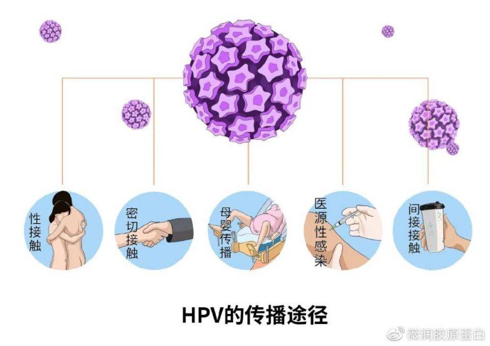 hpv感染是不分男女的，不是女性专属！薇润提醒男性更要警惕！