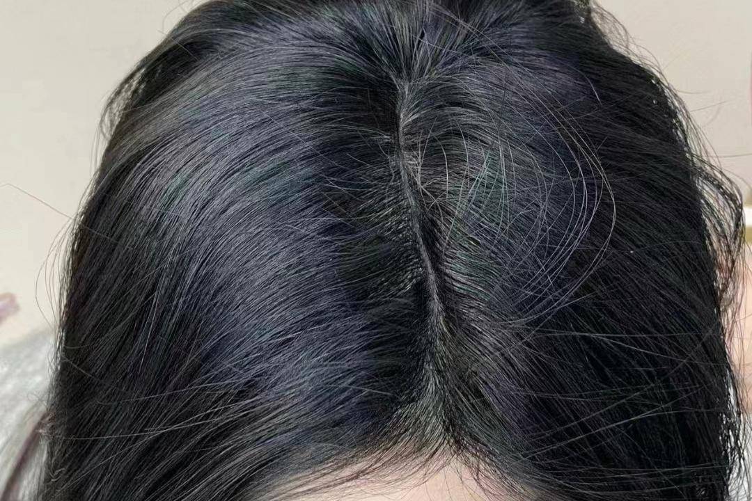 头发又细又软还总掉？过来人教你养发三招！头发秒变坚韧浓密！