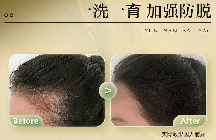 防脫發(fā)的洗發(fā)水什么牌子好？？防脫洗發(fā)水排行榜前10
