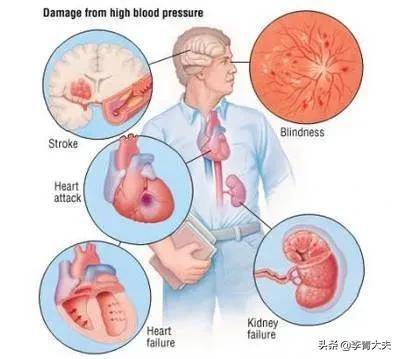 血压才发现了危害她心、肾的另一个“元凶”因为做了这个检查