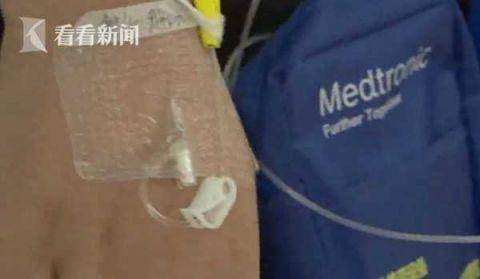 男孩：13岁男孩狂吃辣条后昏迷不醒 医生：没那么简单