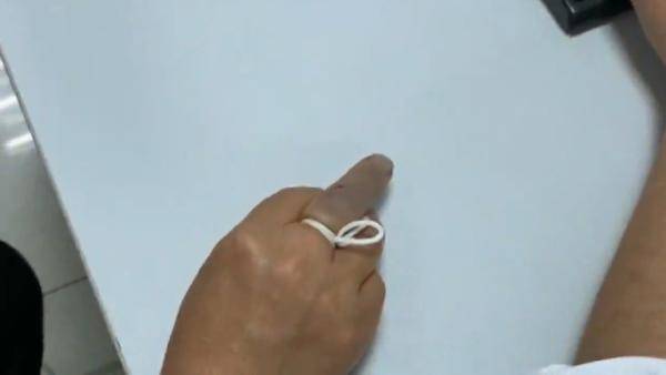 “教科书”式自救！大妈被毒蛇咬伤后一系列操