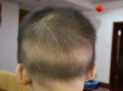 小孩子怎么补头发 cd24516c3748469cb19e4874988e8a2a.jpeg