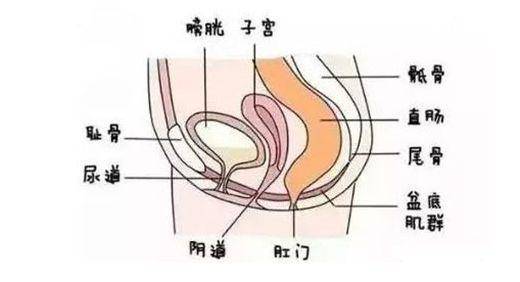 产后漏尿阴道壁膨出子宫脱垂80的产后问题都能靠它解决