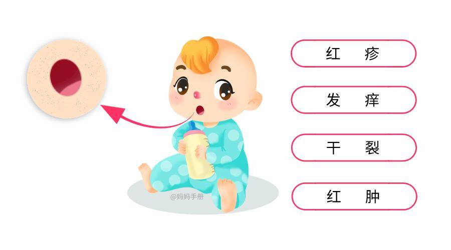 #夏天#家长千万要小心!夏天0~12岁孩子很容易得这个